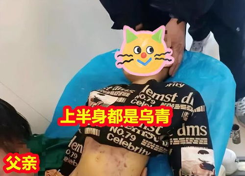 男童遭生母與男友虐待致死,，姥姥期盼嚴(yán)判以伸正義